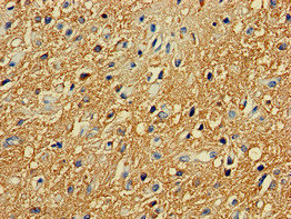 Immunohistochemistry (Formalin/PFA-fixed paraffin-embedded sections) - Anti-PKA R2/PKR2 antibody (AB236855), expandable thumbnail