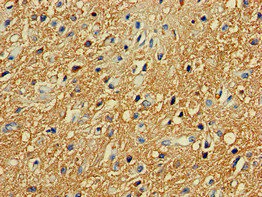 Immunohistochemistry (Formalin/PFA-fixed paraffin-embedded sections) - Anti-PKA R2/PKR2 antibody (AB236855)