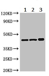 Western blot - Anti-PKA R2/PKR2 antibody (AB236855), expandable thumbnail
