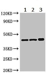 Western blot - Anti-PKA R2/PKR2 antibody (AB236855)
