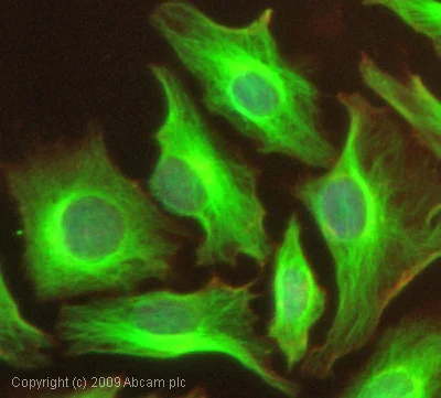 Immunocytochemistry/ Immunofluorescence - Anti-PKA R2/PKR2 antibody (AB38949)