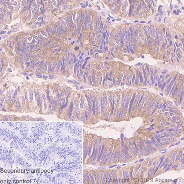 Immunohistochemistry (Formalin/PFA-fixed paraffin-embedded sections) - Anti-PKA R2/PKR2 antibody [Y116] - BSA and Azide free (AB247265)