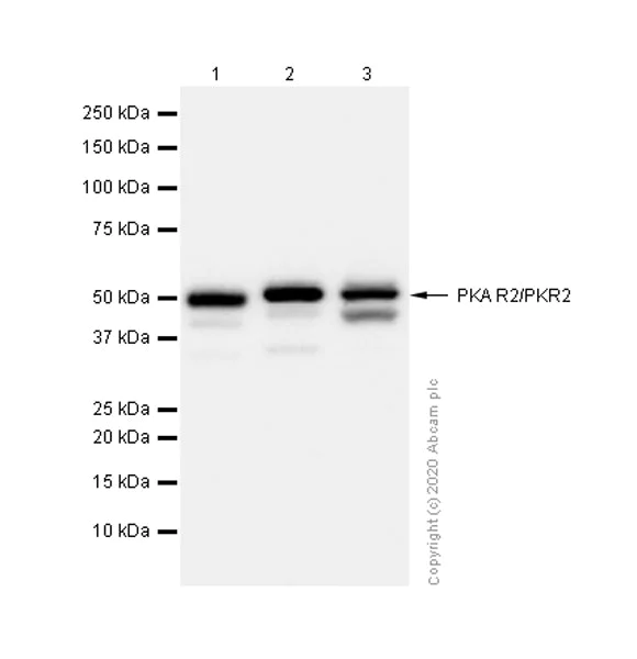Western blot - Anti-PKA R2/PKR2 antibody [Y116] - BSA and Azide free (AB247265)