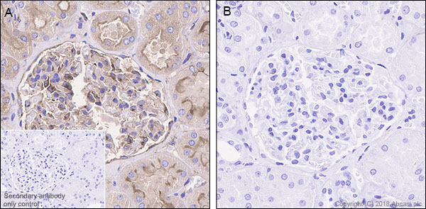 Immunohistochemistry (Formalin/PFA-fixed paraffin-embedded sections) - Anti-PKA R2/PKR2 (phospho S99) antibody [E151] (AB32390)