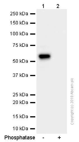 Western blot - Anti-PKA R2/PKR2 (phospho S99) antibody [E151] (AB32390)