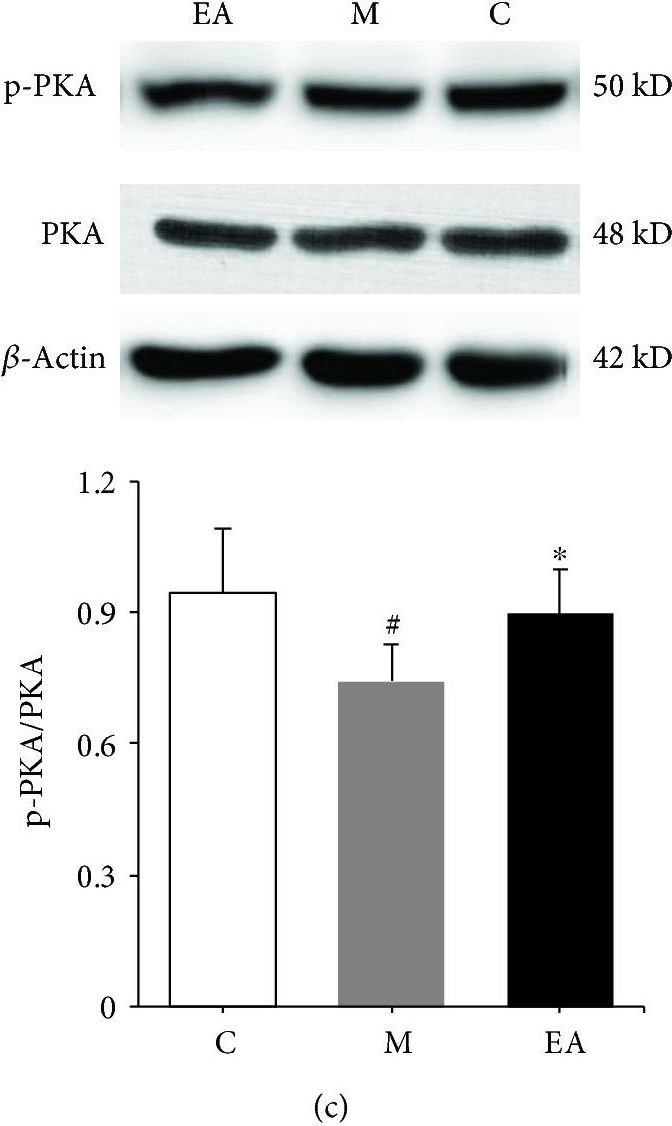Anti-PKA R2/PKR2 (phospho S99) antibody [E151]