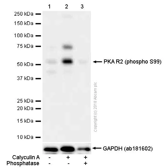 Western blot - Anti-PKA R2/PKR2 (phospho S99) antibody [E151] (AB32390)