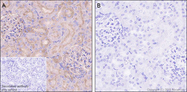 Immunohistochemistry (Formalin/PFA-fixed paraffin-embedded sections) - Anti-PKA R2/PKR2 (phospho S99) antibody [E151] - BSA and Azide free (AB238951)