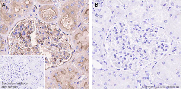 Immunohistochemistry (Formalin/PFA-fixed paraffin-embedded sections) - Anti-PKA R2/PKR2 (phospho S99) antibody [E151] - BSA and Azide free (AB238951)