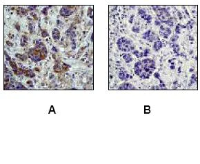 Immunohistochemistry (Formalin/PFA-fixed paraffin-embedded sections) - Anti-PKA R2/PKR2 (phospho S99) antibody [E151] - BSA and Azide free (AB238951)