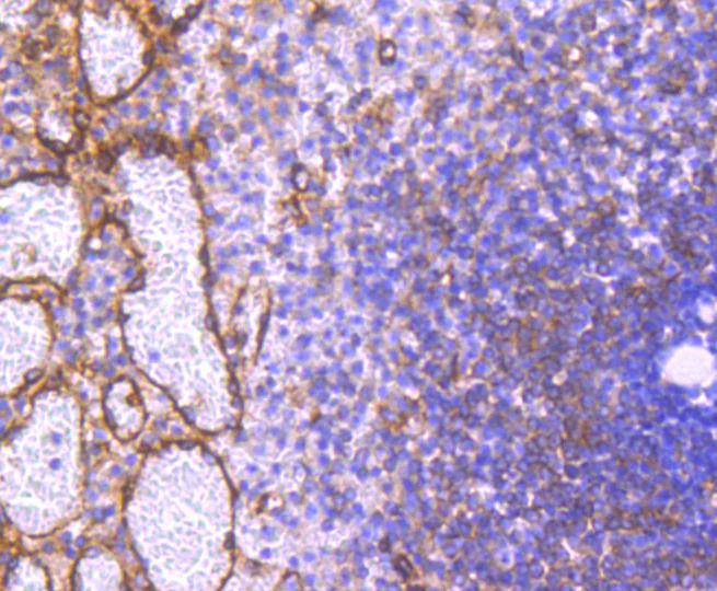 Immunohistochemistry (Formalin/PFA-fixed paraffin-embedded sections) - Anti-PKA R2/PKR2 (phospho S99) antibody [SC54-04] (AB326622)