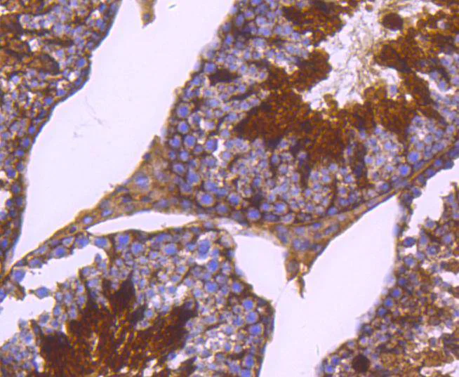 Immunohistochemistry (Formalin/PFA-fixed paraffin-embedded sections) - Anti-PKA R2/PKR2 (phospho S99) antibody [SC54-04] (AB326622)