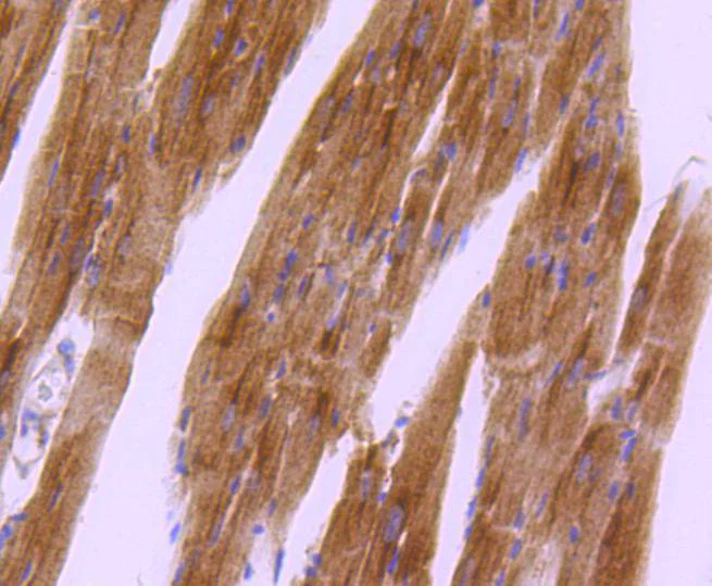 Immunohistochemistry (Formalin/PFA-fixed paraffin-embedded sections) - Anti-PKA R2/PKR2 (phospho S99) antibody [SC54-04] (AB326622)