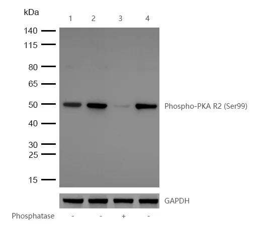 Western blot - Anti-PKA R2/PKR2 (phospho S99) antibody [SC54-04] (AB326622)