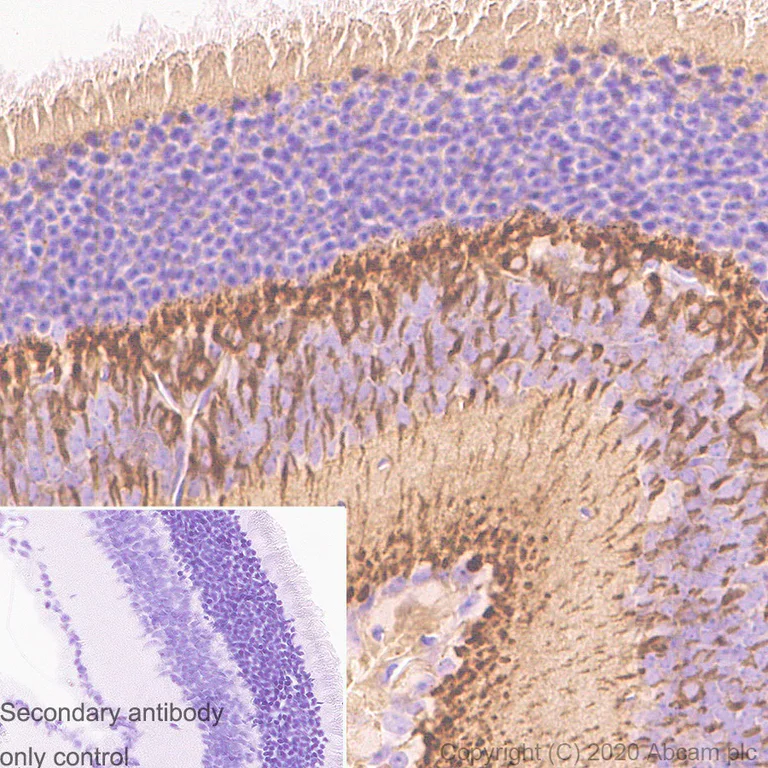 Immunohistochemistry (Formalin/PFA-fixed paraffin-embedded sections) - Anti-PKC alpha antibody [133] - BSA and Azide free (AB284403)