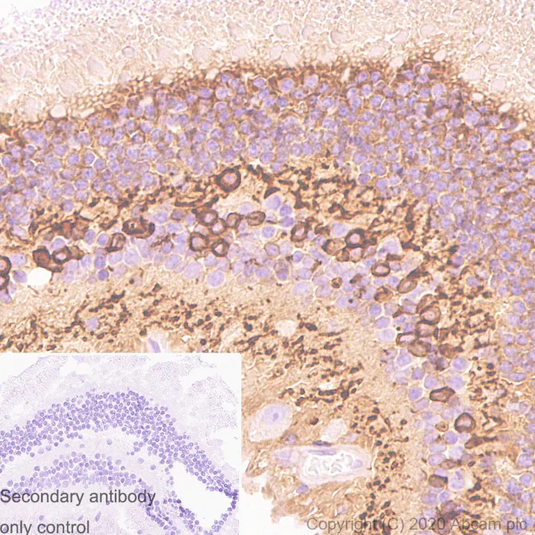 Immunohistochemistry (Formalin/PFA-fixed paraffin-embedded sections) - Anti-PKC alpha antibody [133] - BSA and Azide free (AB284403)