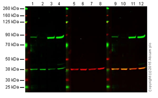Western blot - Anti-PKC alpha antibody [133] - BSA and Azide free (AB284403), expandable thumbnail