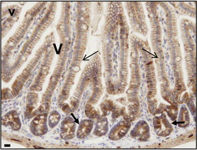 Immunohistochemistry (Formalin/PFA-fixed paraffin-embedded sections) - Anti-PKC alpha antibody [Y124] (AB32376)