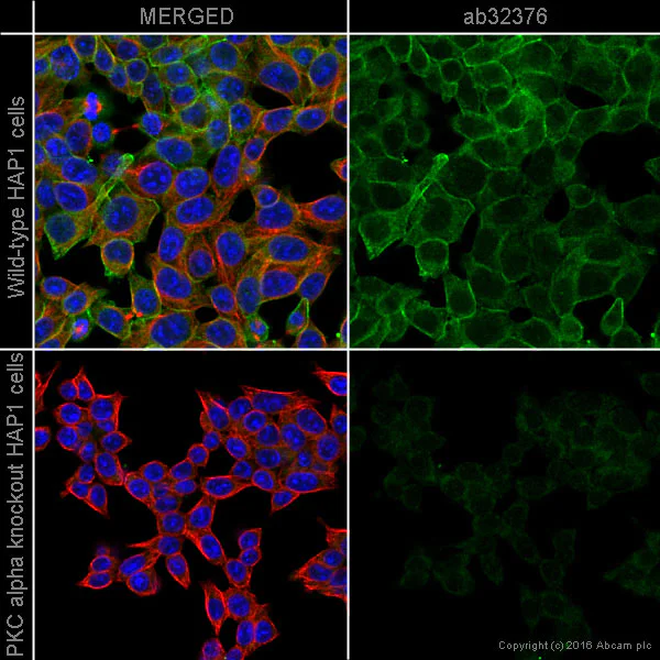 Immunocytochemistry/ Immunofluorescence - Anti-PKC alpha antibody [Y124] - BSA and Azide free (AB221611)