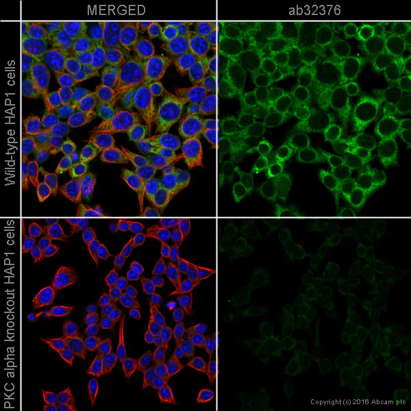 Immunocytochemistry/ Immunofluorescence - Anti-PKC alpha antibody [Y124] - BSA and Azide free (AB221611)