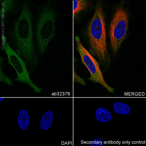 Immunocytochemistry/ Immunofluorescence - Anti-PKC alpha antibody [Y124] - BSA and Azide free (AB221611)
