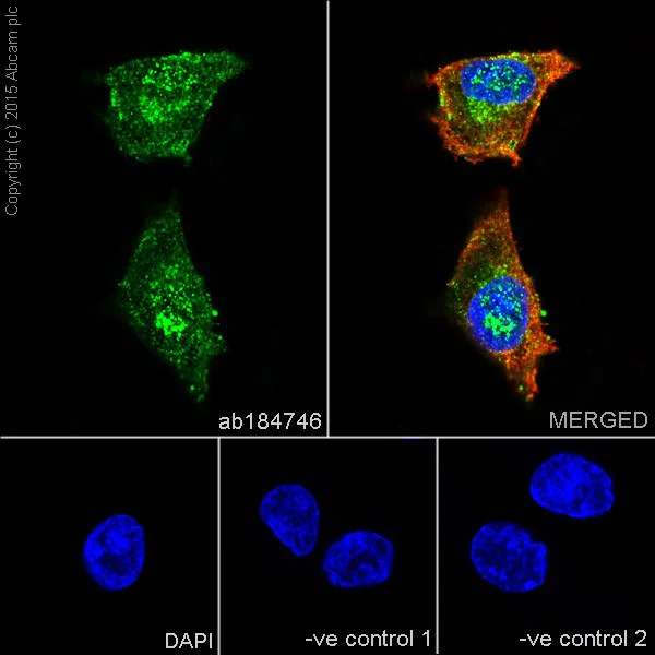 Immunocytochemistry/ Immunofluorescence - Anti-PKC alpha + beta 2 + gamma antibody [EPR18104] (AB184746)