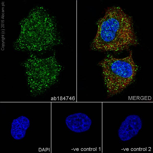 Immunocytochemistry/ Immunofluorescence - Anti-PKC alpha + beta 2 + gamma antibody [EPR18104] (AB184746)