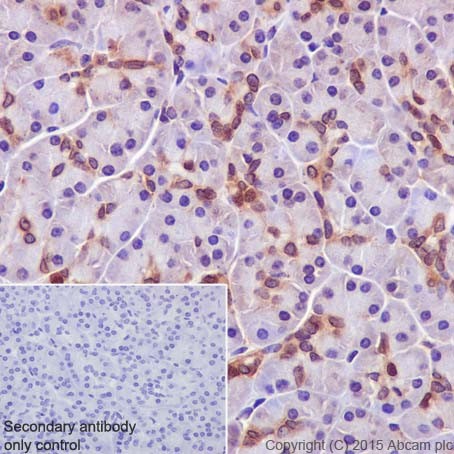 Immunohistochemistry (Formalin/PFA-fixed paraffin-embedded sections) - Anti-PKC alpha + beta 2 + gamma antibody [EPR18104] (AB184746)