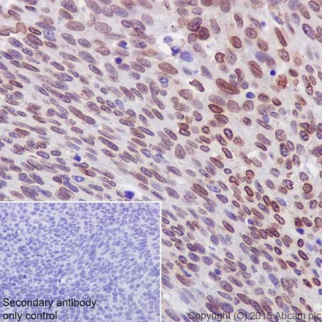 Immunohistochemistry (Formalin/PFA-fixed paraffin-embedded sections) - Anti-PKC alpha + beta 2 + gamma antibody [EPR18104] (AB184746)