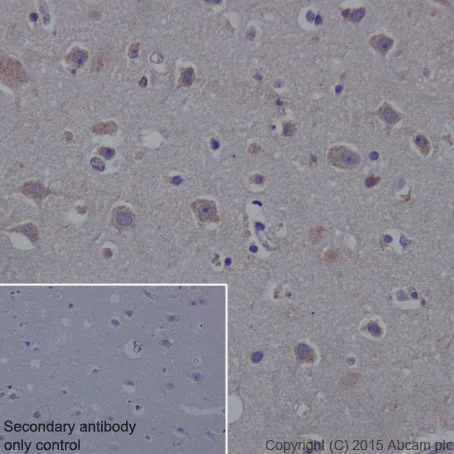 Immunohistochemistry (Formalin/PFA-fixed paraffin-embedded sections) - Anti-PKC alpha + beta 2 + gamma antibody [EPR18104] - BSA and Azide free (AB250778)