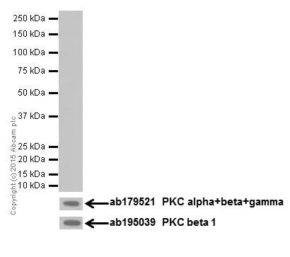 Western blot - Anti-PKC alpha + beta 2 + gamma antibody [EPR18104] - BSA and Azide free (AB250778)