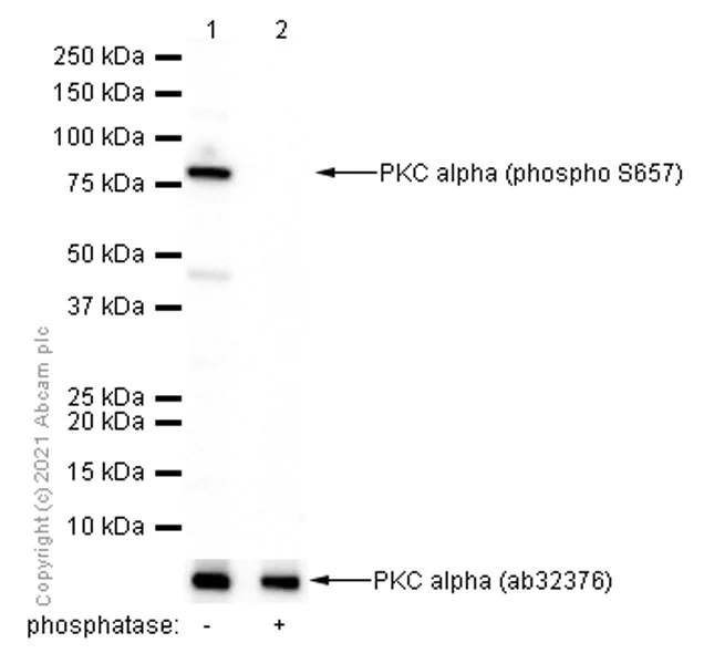 Western blot - Anti-PKC alpha (phospho S657) antibody [EPR1901(2)] (AB180848)