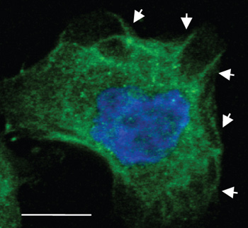 Immunocytochemistry - Anti-PKC alpha (phospho S657 + Y658) antibody (AB23513)