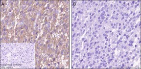 Immunohistochemistry (Formalin/PFA-fixed paraffin-embedded sections) - Anti-PKC alpha (phospho T497) antibody [EP2608Y] (AB76016)