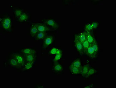 Immunocytochemistry/ Immunofluorescence - Anti-PKC alpha (phospho T638) antibody [3A5] (AB314198)