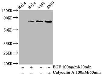 Western blot - Anti-PKC alpha (phospho T638) antibody [3A5] (AB314198)