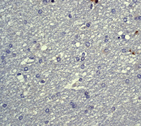 Immunohistochemistry (Formalin/PFA-fixed paraffin-embedded sections) - Anti-PKC alpha (phospho T638) antibody [E195] (AB32502), expandable thumbnail