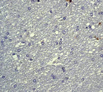Immunohistochemistry (Formalin/PFA-fixed paraffin-embedded sections) - Anti-PKC alpha (phospho T638) antibody [E195] (AB32502)