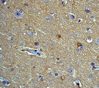 Immunohistochemistry (Formalin/PFA-fixed paraffin-embedded sections) - Anti-PKC alpha (phospho T638) antibody [E195] (AB32502), expandable thumbnail
