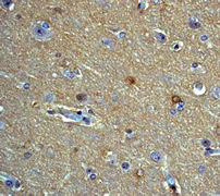 Immunohistochemistry (Formalin/PFA-fixed paraffin-embedded sections) - Anti-PKC alpha (phospho T638) antibody [E195] (AB32502)