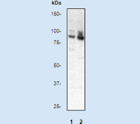 Western blot - Anti-PKC alpha (phospho T638) antibody [E195] (AB32502), expandable thumbnail