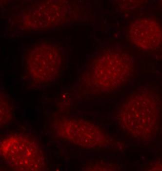 Immunocytochemistry/ Immunofluorescence - Anti-PKC alpha (phospho T638) + PKC beta II (phospho T641) antibody (AB194749)