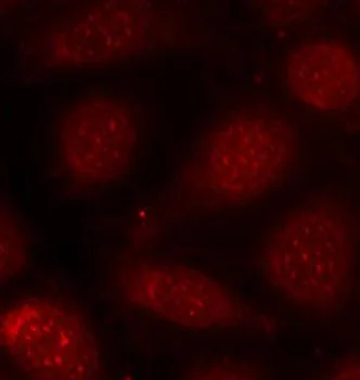 Immunocytochemistry/ Immunofluorescence - Anti-PKC alpha (phospho T638) + PKC beta II (phospho T641) antibody (AB194749)