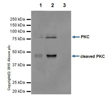 Immunoprecipitation - Anti-PKC antibody [EPR16791] (AB179523)
