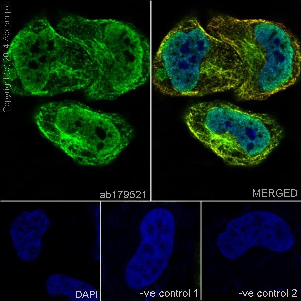 Immunocytochemistry/ Immunofluorescence - Anti-PKC antibody [EPR16794] (ab179521), expandable thumbnail