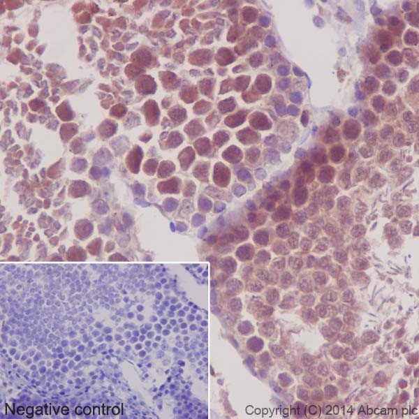 Immunohistochemistry (Formalin/PFA-fixed paraffin-embedded sections) - Anti-PKC antibody [EPR16794] (ab179521), expandable thumbnail