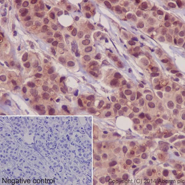 Immunohistochemistry (Formalin/PFA-fixed paraffin-embedded sections) - Anti-PKC antibody [EPR16794] (ab179521), expandable thumbnail