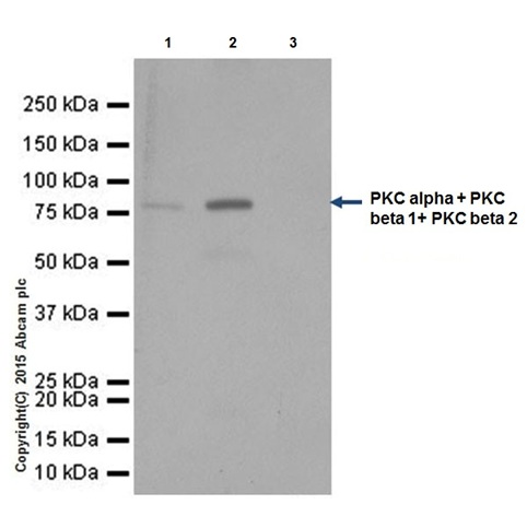 Immunoprecipitation - Anti-PKC antibody [EPR16794] (ab179521), expandable thumbnail