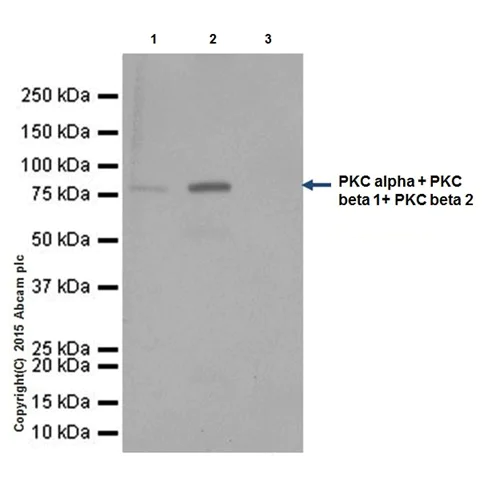 Immunoprecipitation - Anti-PKC antibody [EPR16794] (AB179521)