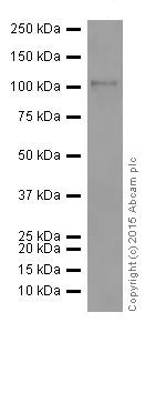 Western blot - Anti-PKC antibody [EPR16794] (AB179521)